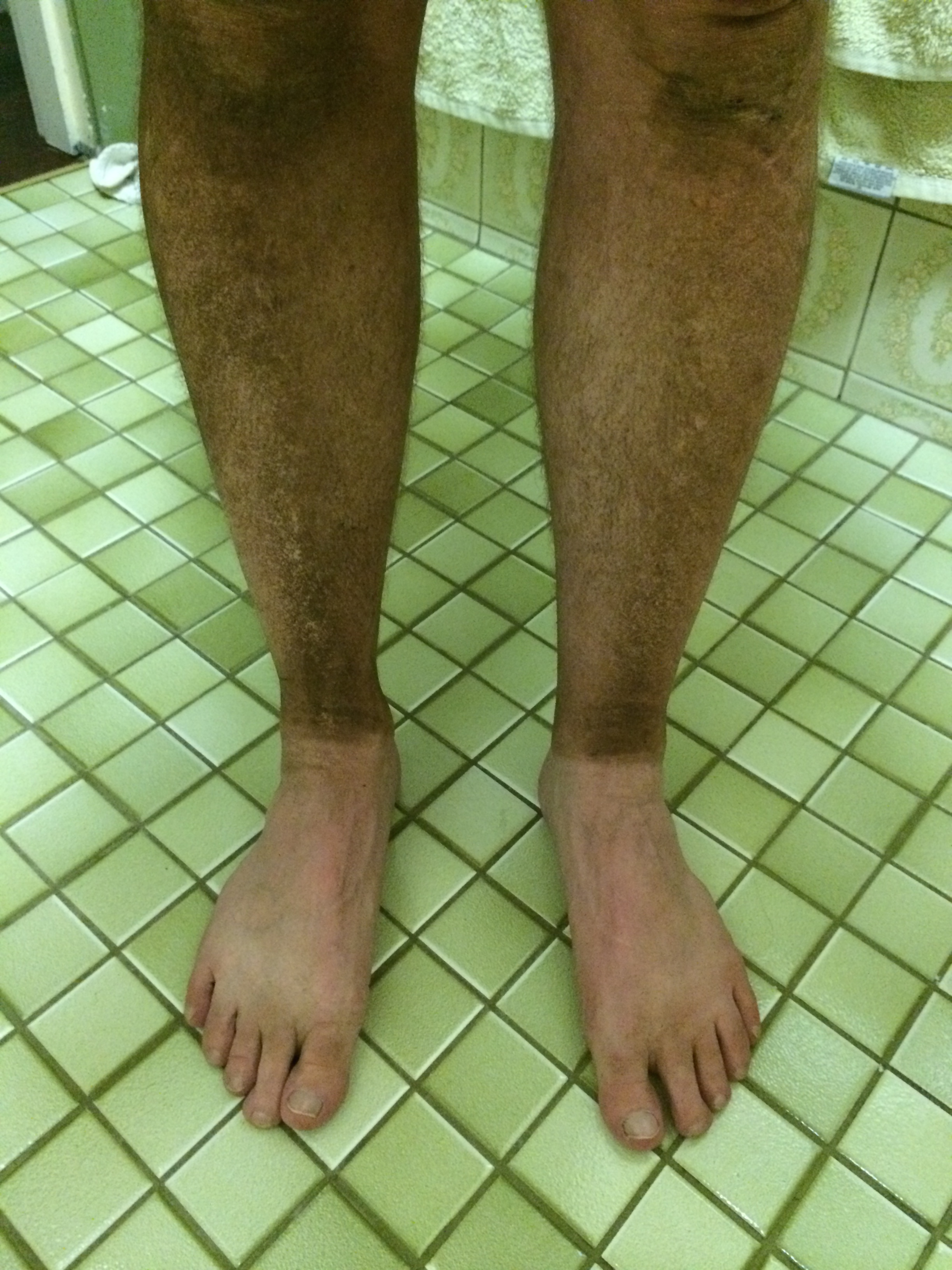 My Munda Biddi Suntan - from dust