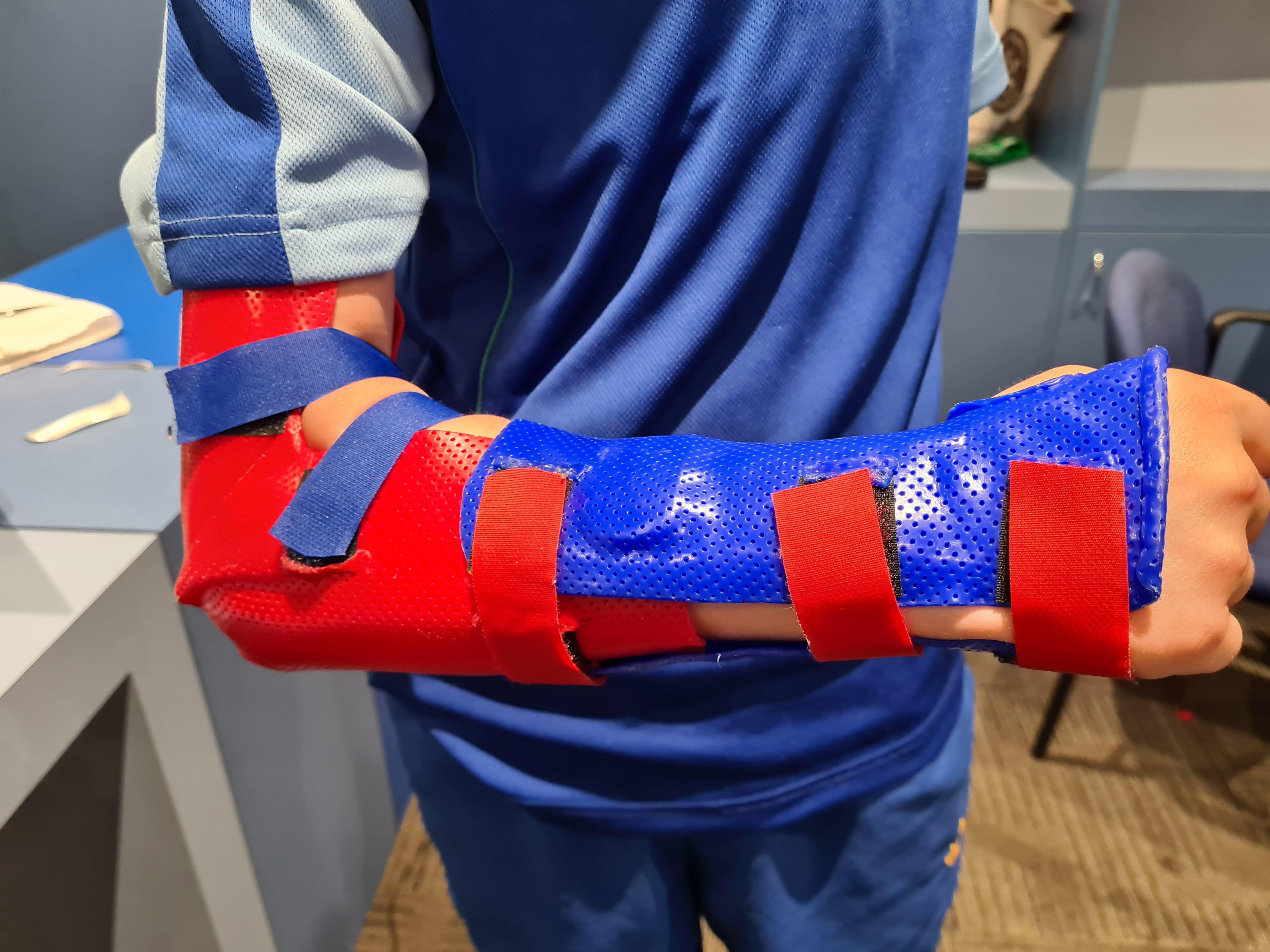 Case Study Greenstick Fracture Flex Physio