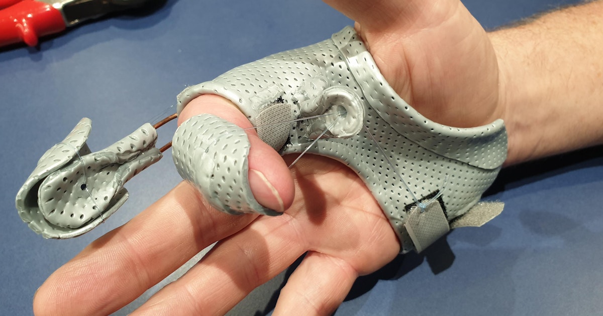 PIP Joint Stiffness Flex Physio